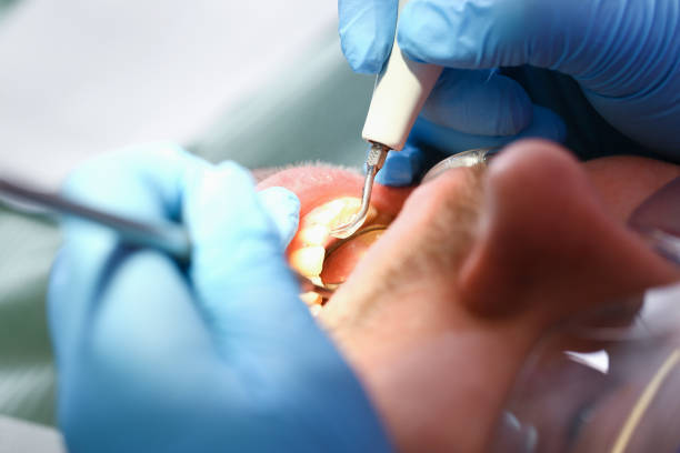 Best Urgent Care for Lost Fillings or Crowns in Indnola, IA