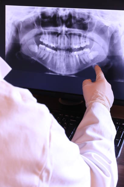 Best Emergency Dental Care for Broken or Chipped Teeth in Indnola, IA