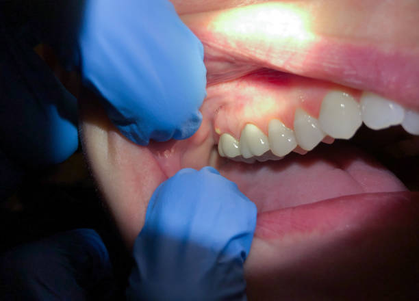 Best Pediatric Emergency Dentist in Indnola, IA